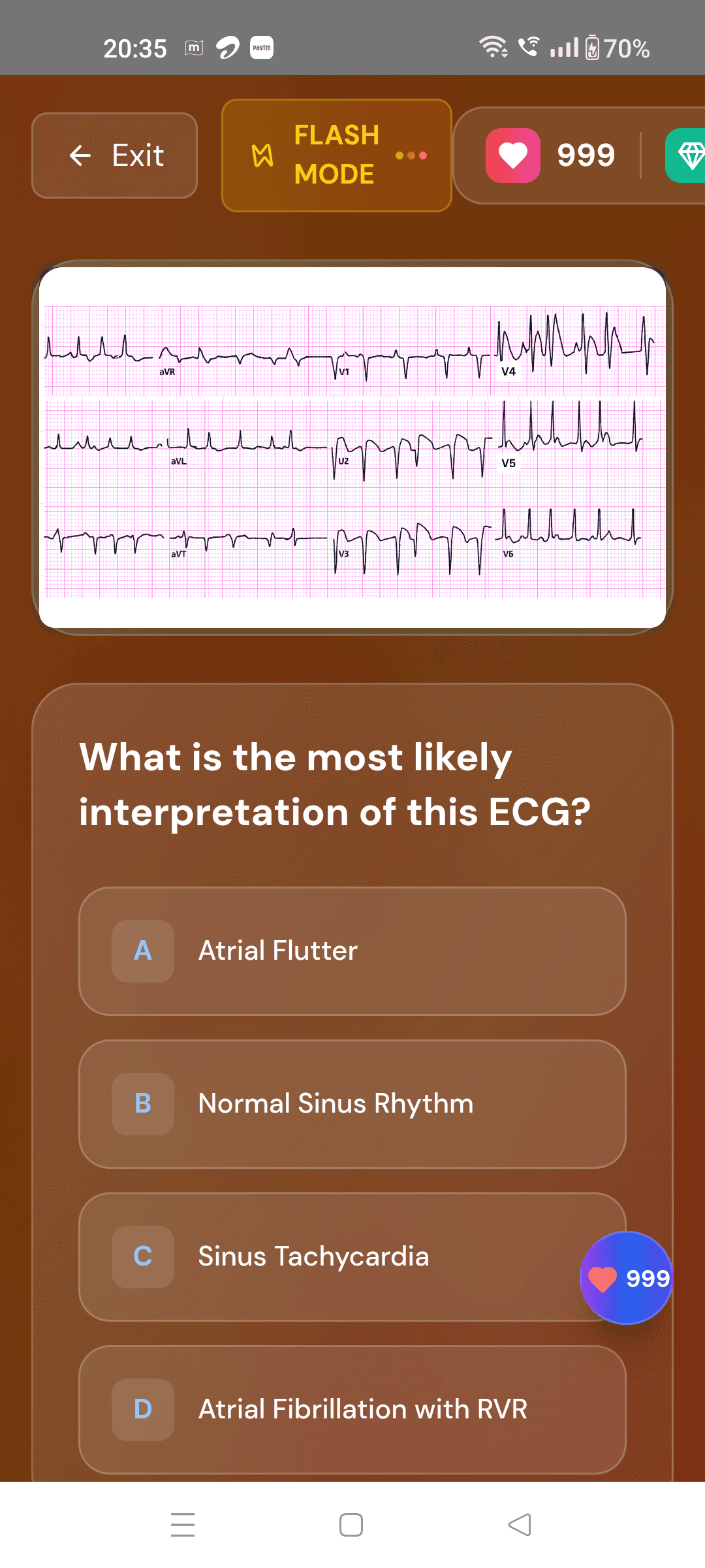 ECG Practice App Screenshot 3