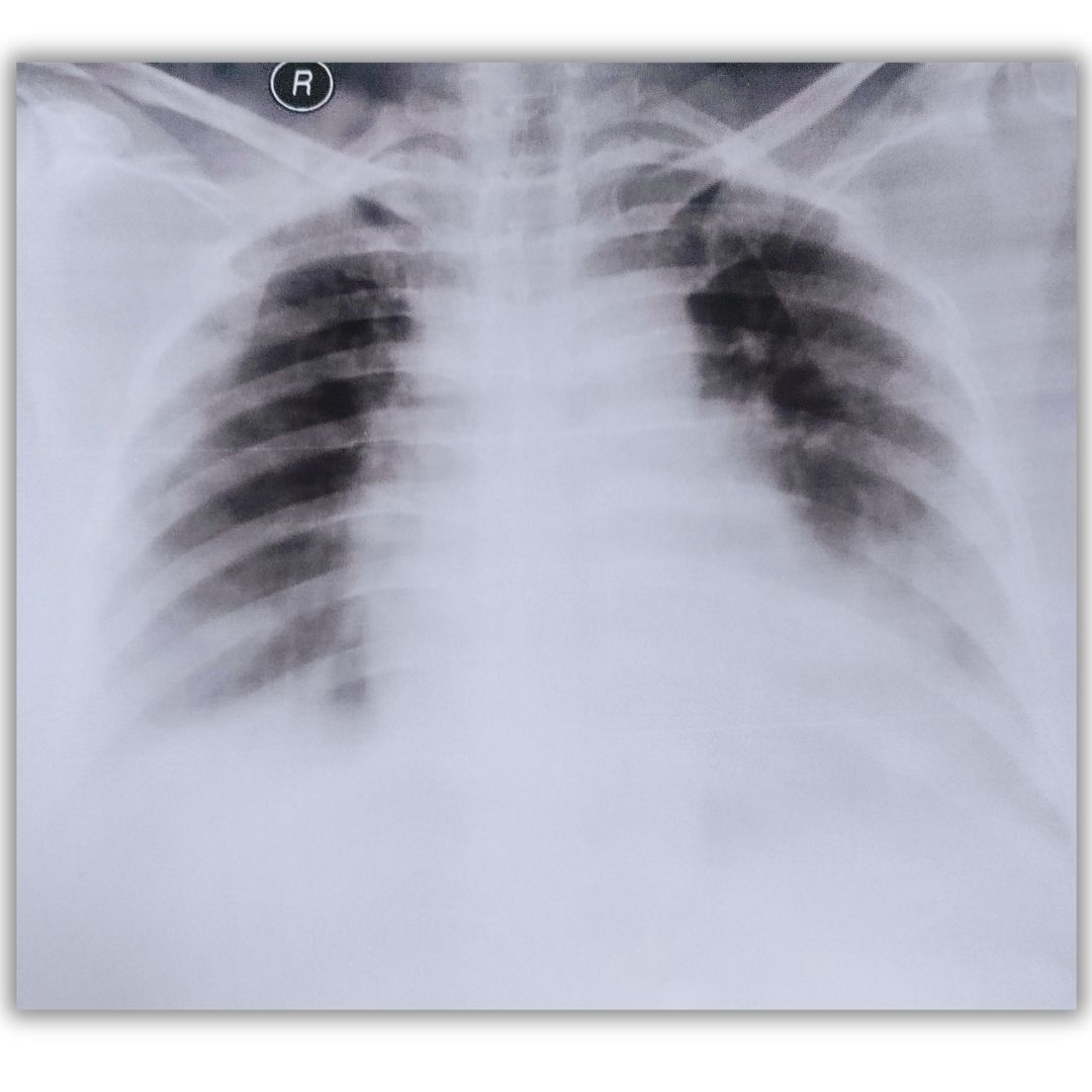 Original X-ray