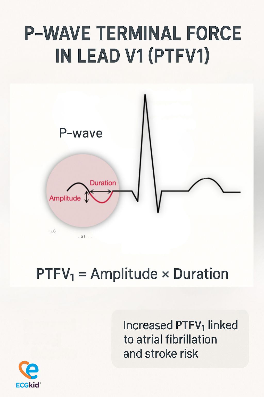 Graph showing HR increase in AF with PTFV1 > 4000 μV·ms