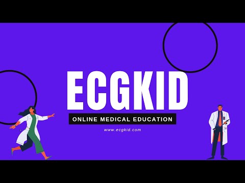 How to identify ECG patterns due to misplaced leads on ECG recording
